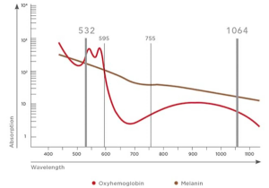 remove brown spots cutera two wavelengths excel v+ westrick clinic