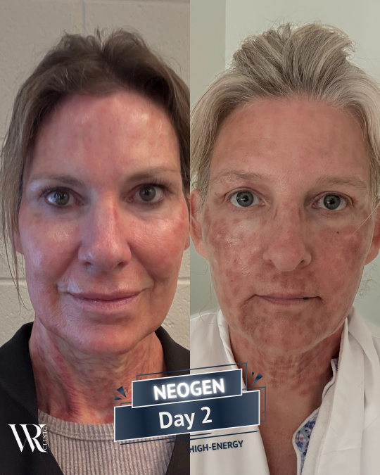 Westrick Clinic NEOGEN JOURNEY Sue west Lisa Patrick