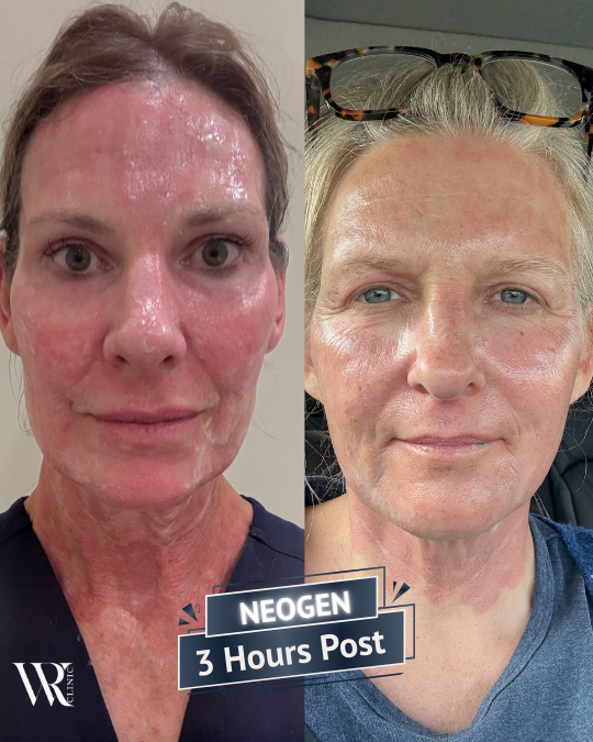 Westrick Clinic NEOGEN JOURNEY Sue west Lisa Patrick Day 1 - 3 hours