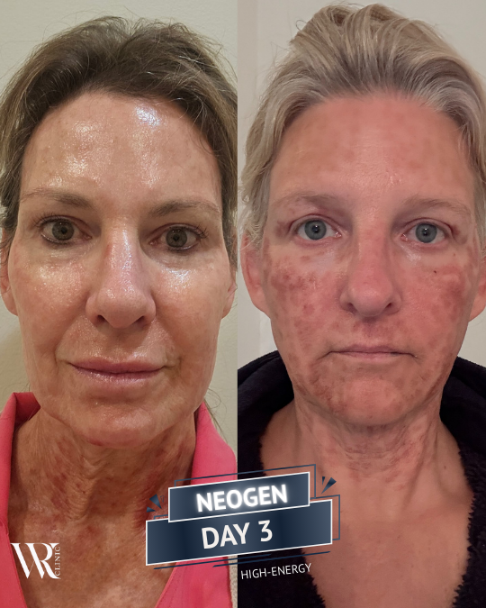 Westrick Clinic NEOGEN JOURNEY Sue west Lisa Patrick