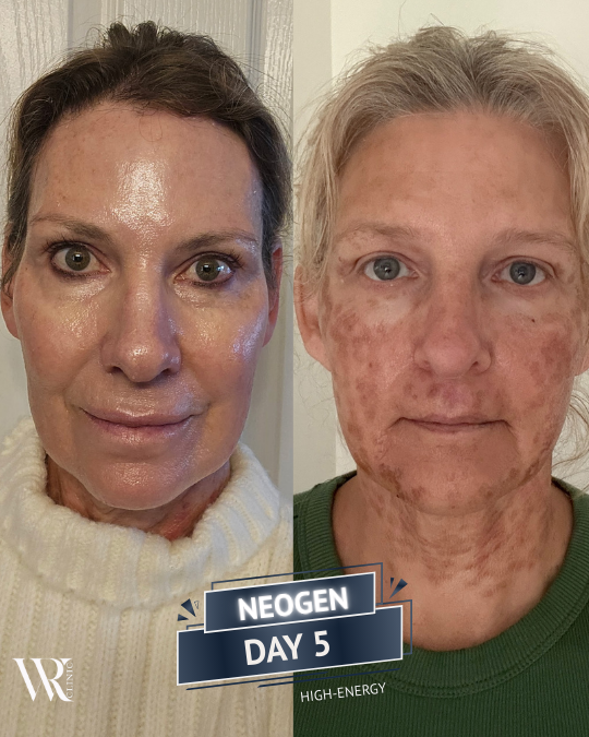 Westrick Clinic NEOGEN JOURNEY Sue west Lisa Patrick