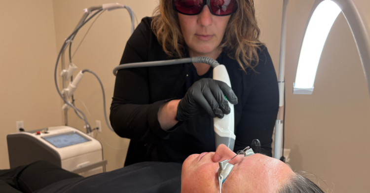 Laser genesis warm facial westrick clinic