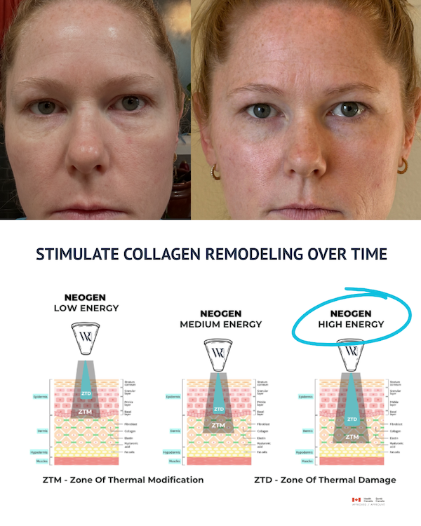 Westrick clinic westrick clinic carissa neogen journey at westrick clinic - what happens to our skin as we age