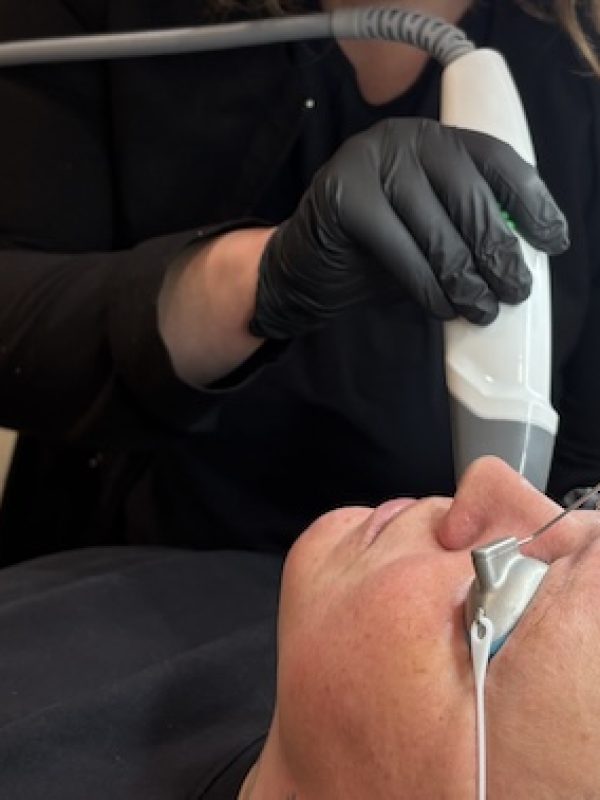 Genesis Laser Facial Westrick Clinic